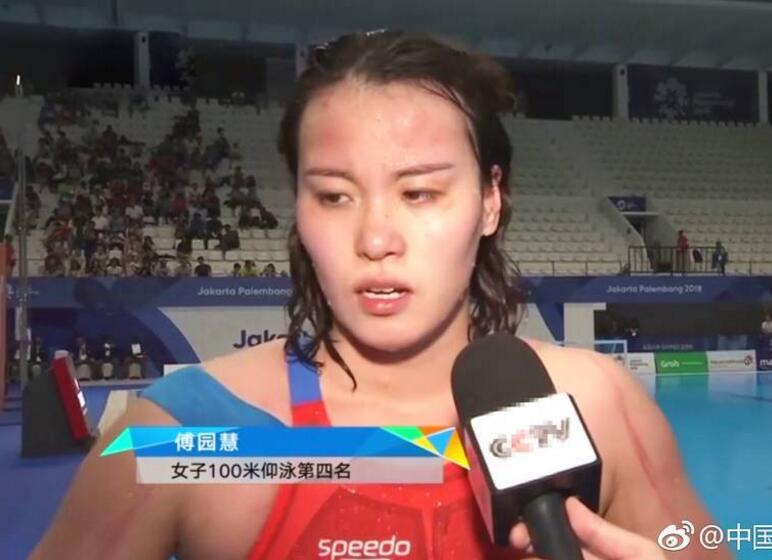 亚运会上 傅园慧满身抓痕引关注